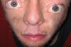 Face Transformation Pictures