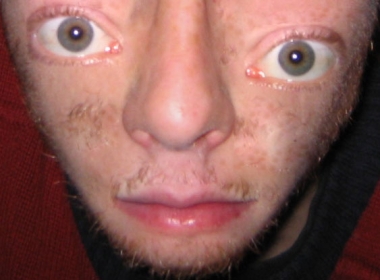 Deformed Face pics