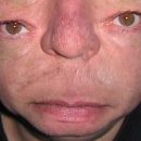 Face Transformation Pictures