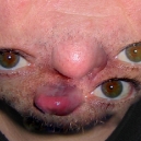 Face Transformation Photo