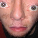 Deformed Face pics
